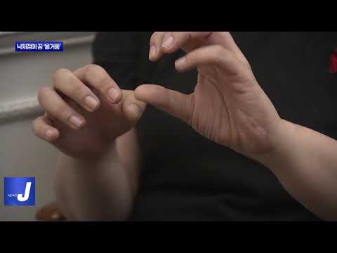 황당한 F학점…졸업도 국가시험도 ‘물거품’